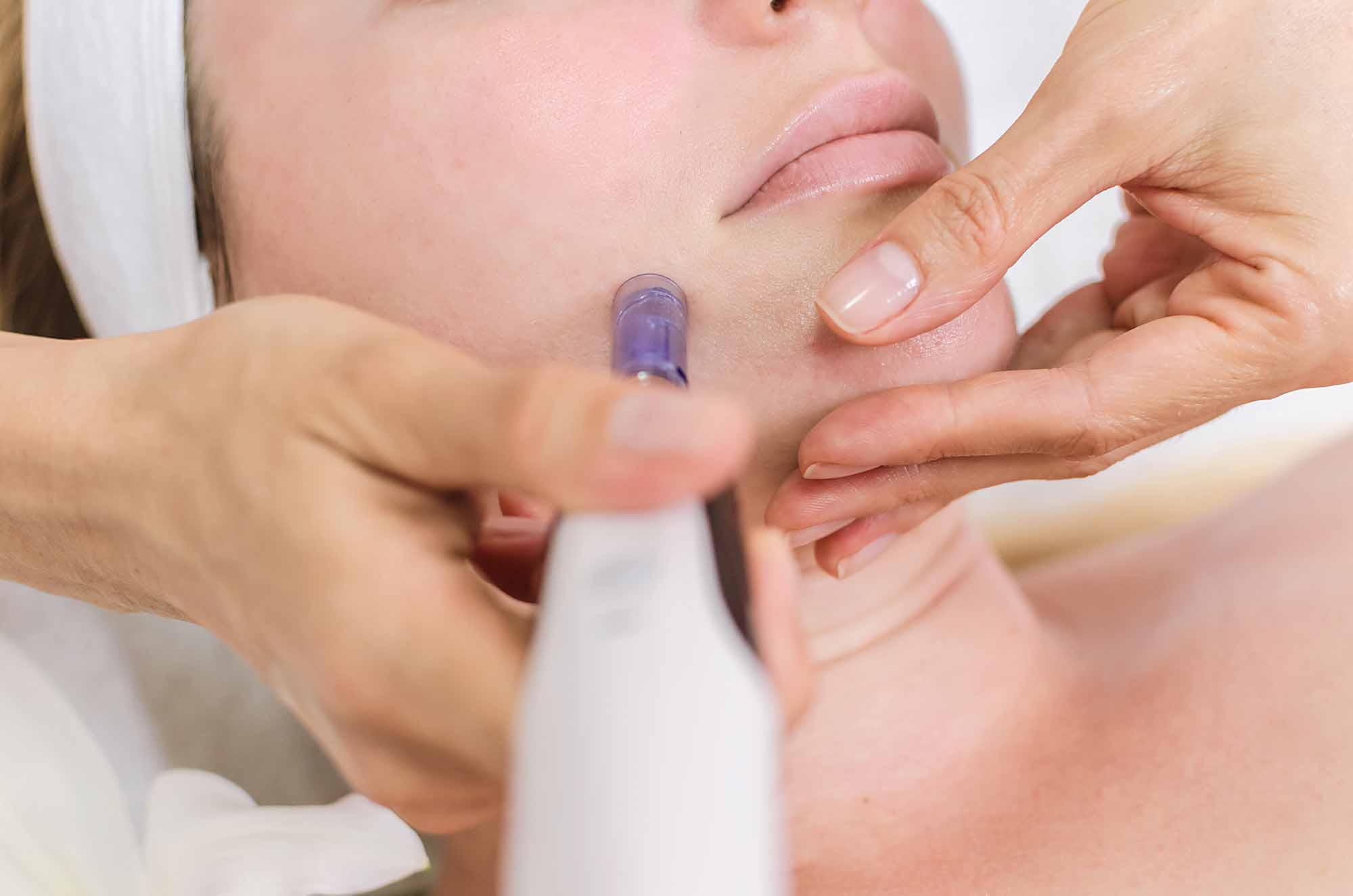 Medisinsk SkinPen microneedling
