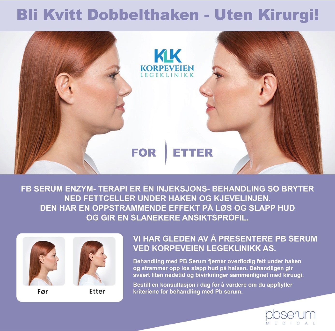 PB-serum