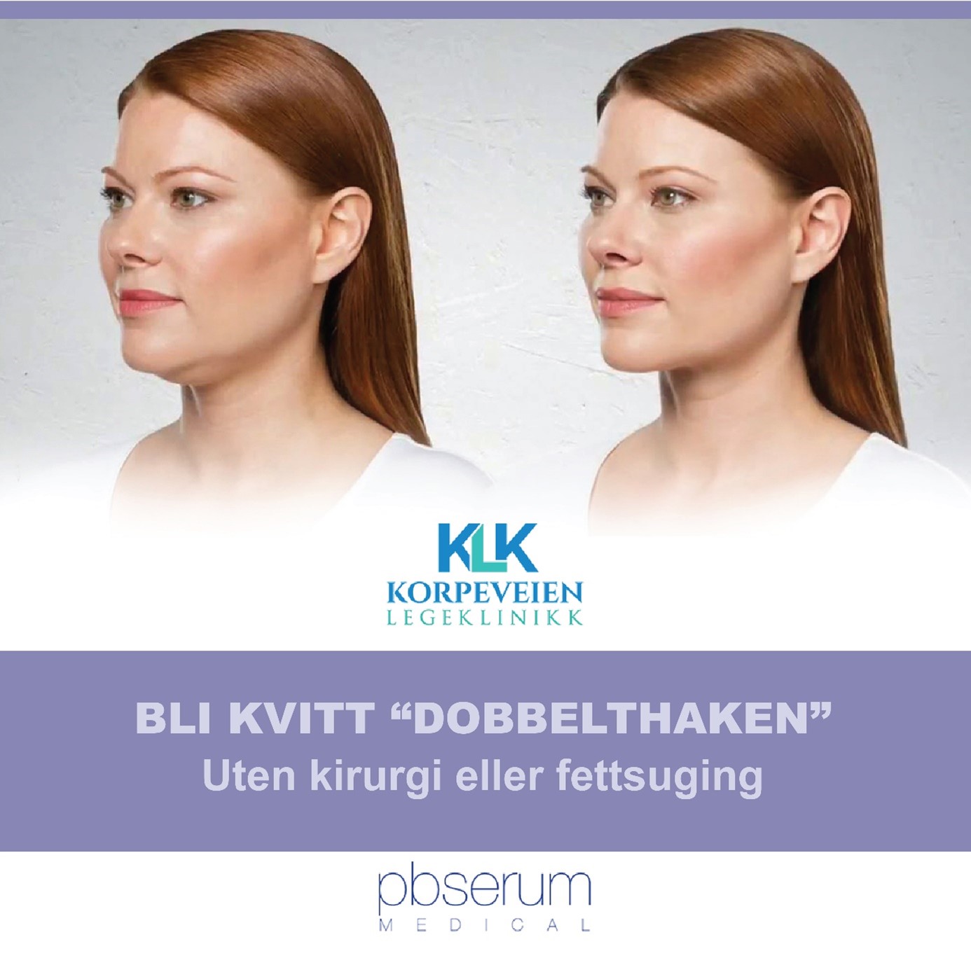 pb-serum